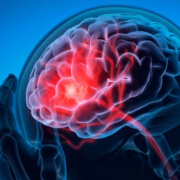 Cerebro